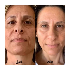 قرص ایمدین تایم پرفکشن اصل برند فایزر دانمارک | جوانساز و ضد پیری