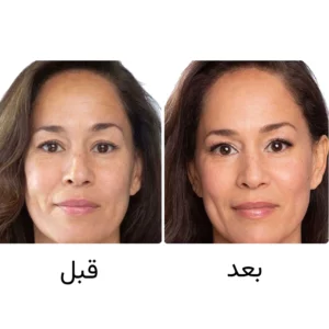 قرص ایمدین تایم پرفکشن اصل برند فایزر دانمارک | جوانساز و ضد پیری