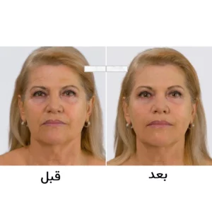 قرص ایمدین تایم پرفکشن اصل برند فایزر دانمارک | جوانساز و ضد پیری