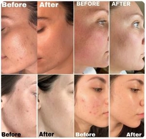 قرص رتینول جوانساز مای ویتامینز 90عددی ضدپیری MyVitamins Retinol