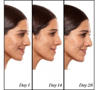 قرص رتینول جوانساز مای ویتامینز 90عددی ضدپیری MyVitamins Retinol