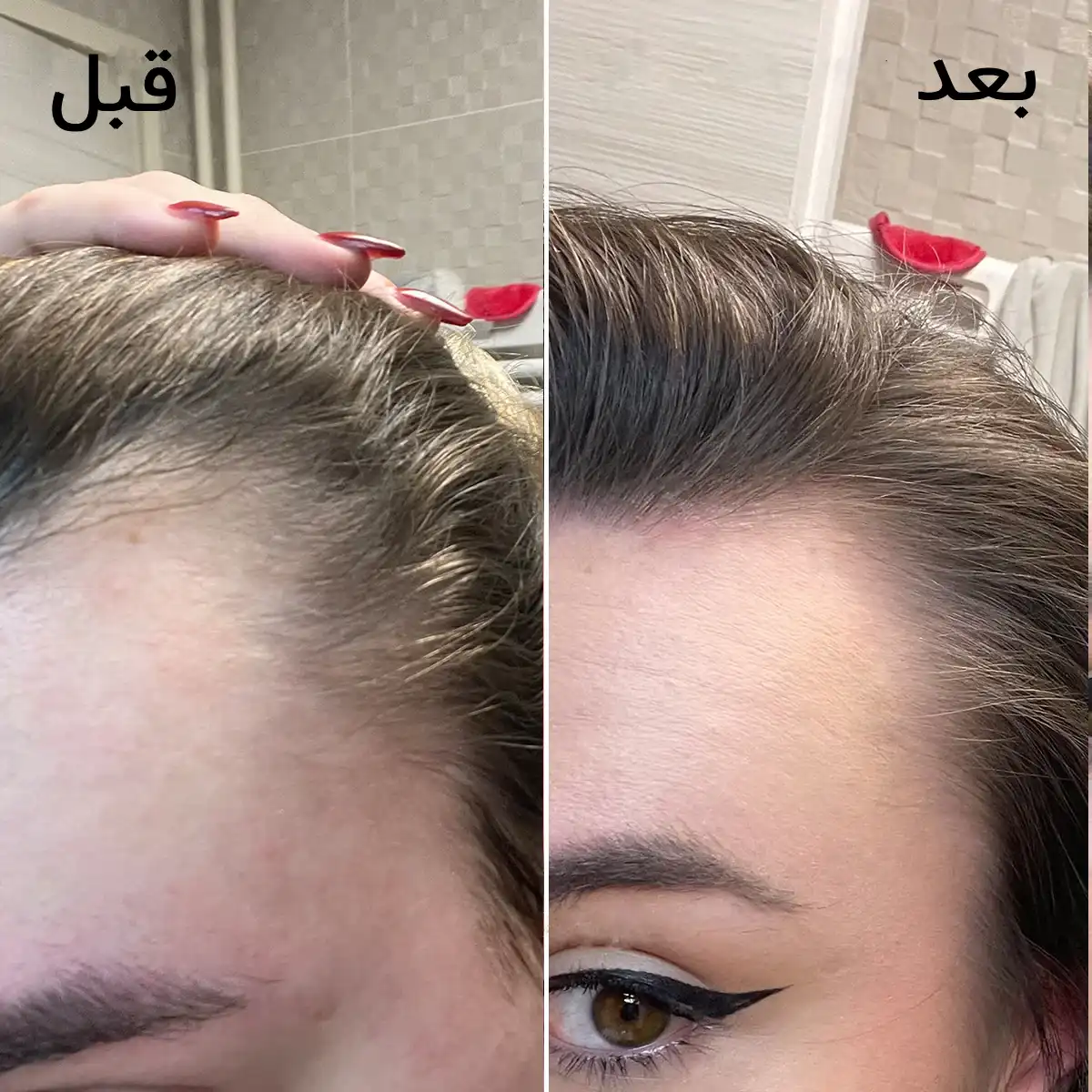 قرص فیتو اصل مکمل ضد ریزش مو