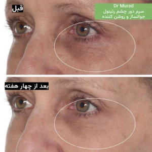 کرم دور چشم رتینول دکتر مورد جوانساز قوی و ضدچروک Dr Murad