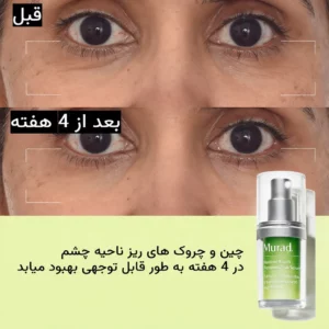 کرم دور چشم رتینول دکتر مورد جوانساز قوی و ضدچروک Dr Murad