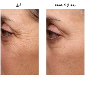 کرم دور چشم رتینول دکتر مورد جوانساز قوی و ضدچروک Dr Murad