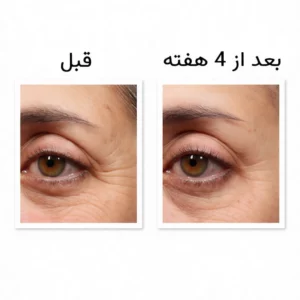 کرم دور چشم رتینول دکتر مورد جوانساز قوی و ضدچروک Dr Murad