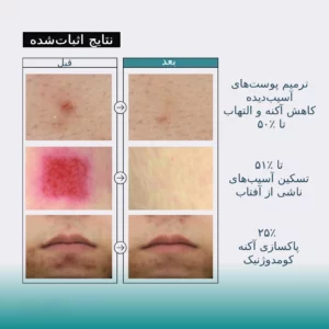 اسنس حلزون جومیسو + پپتاید | آبرسان و ترمیم کننده ۱۴۰ میل