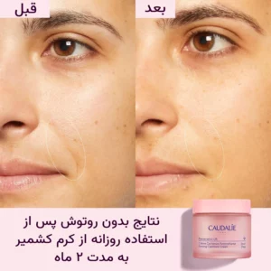 کرم لیفتینگ روز کدلی مدل رزوراترول رفع کننده کم آبی، چروک و افتادگی صورت