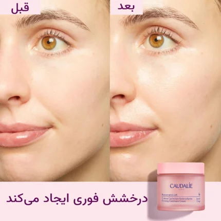 کرم لیفتینگ روز کدلی مدل رزوراترول رفع کننده کم آبی، چروک و افتادگی صورت